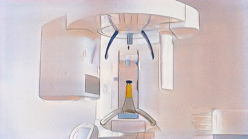 Scanner dentaire à Paris