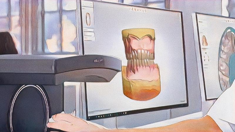 Un scanner 3d dentaire Un scanner 3d dentaire